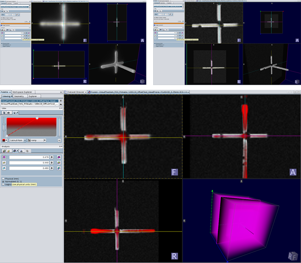 Grafik aus How to Verify the Alignment of PET and MRI (ib6uvkf2.png)