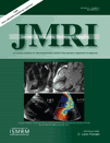 Neurodegeneration in NPC Mice by T2 and DTI MRI