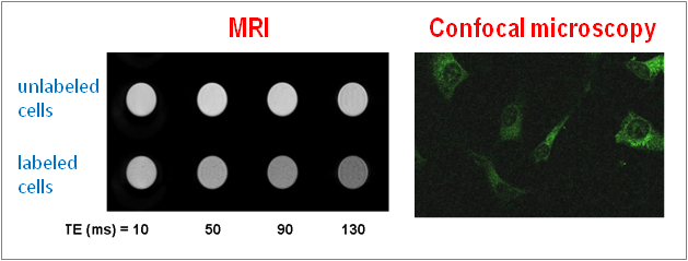 Novel MRI contrast agents: peptide-SPION conjugates